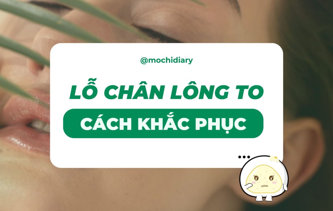 (ẢNH BÌA) lo_chan_long_to_va_cach_khac_phuc (ẢNH BÌA) lo_chan_long_to_va_cach_khac_phuc