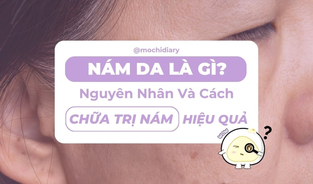 Ảnh bìa_ nam-da-la-gi-nguyen-nhan-va-cach-chua-tri-nam-hieu-qua_5 Ảnh bìa_ nam-da-la-gi-nguyen-nhan-va-cach-chua-tri-nam-hieu-qua_5