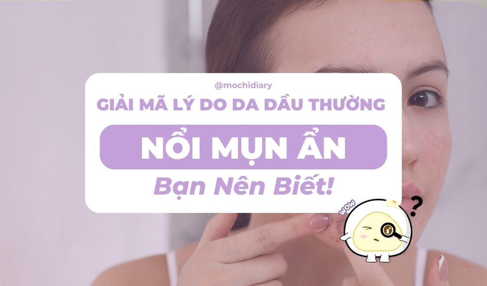 Ảnh bìa_ giai-ma-ly-do-da-dau-thuong-noi-mun-an-ban-nen-biet