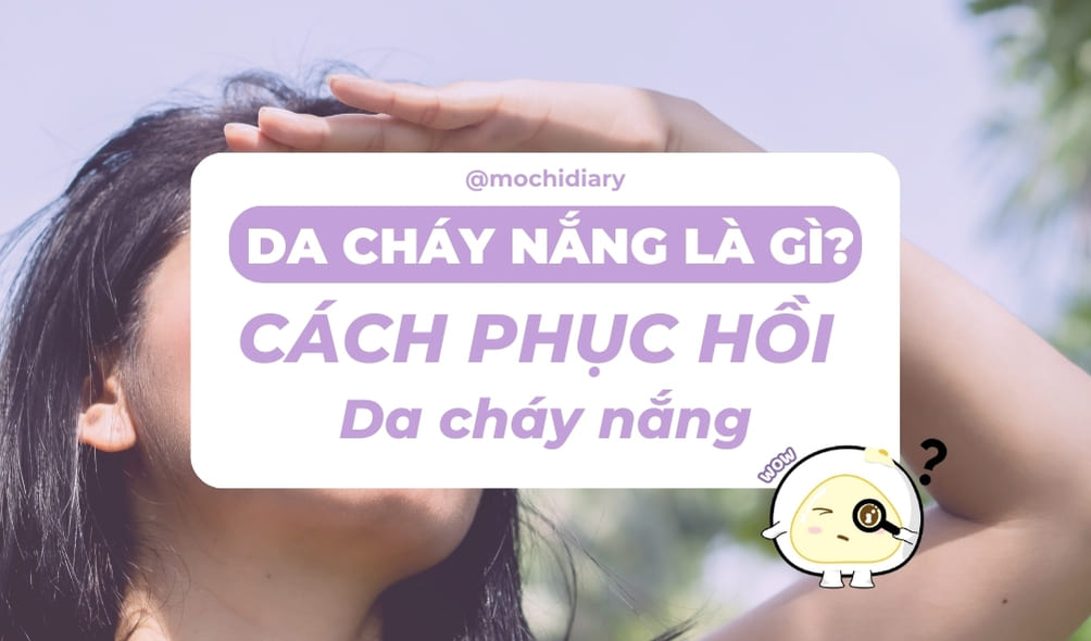 Hình bìa. Da-chay-nang-la-gi-cach-phuc-hoi-da-chay-nang_01 Hình bìa. Da-chay-nang-la-gi-cach-phuc-hoi-da-chay-nang_01