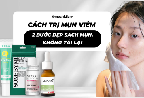 Cách Trị Mụn Viêm Tại Nhà: Nhanh, An Toàn, Không Tái Phát