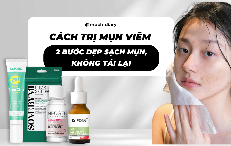hết mụn đón noen (1)